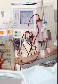 什么是血液透析诱导期