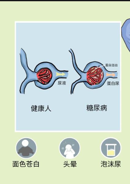 肾小球肾炎有哪些症状?该如何治疗?