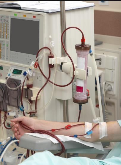 肾衰竭患者肌酐高不透析怎么治疗?