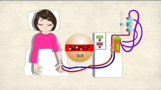 血液透析和腹膜透析有何不同