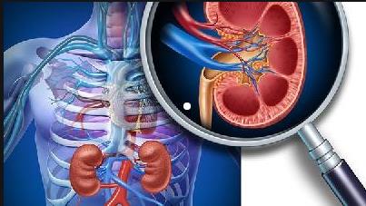 肾小球肾炎 肾小球肾炎